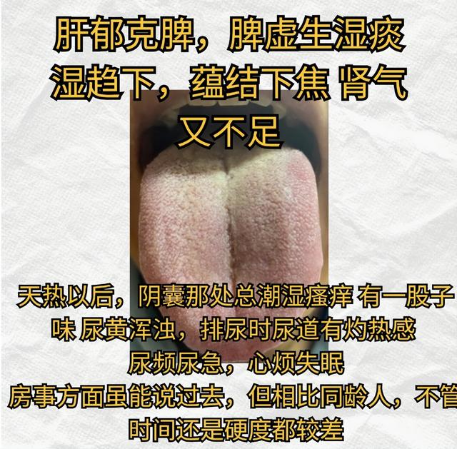 柴胡舒肝丸用好用对，肝气畅通，脾胃强壮，双目有神，睡眠好！