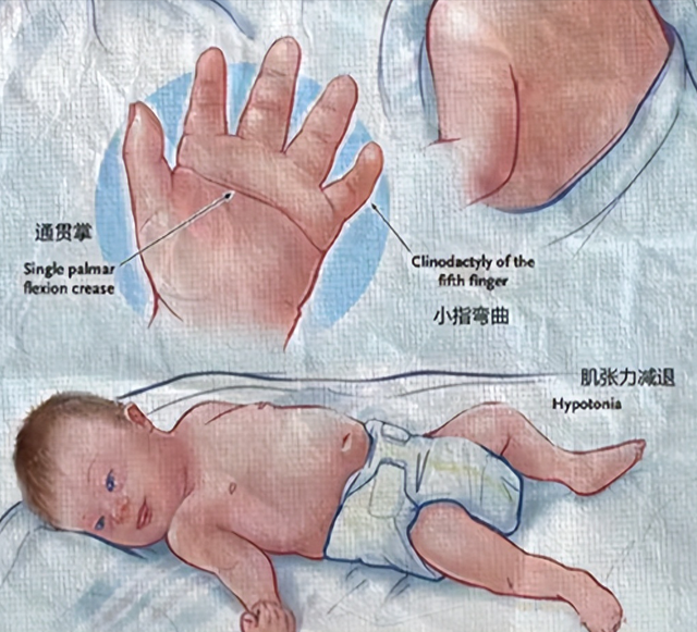 “唐” 字玩梗相关乱象:从对唐氏群体伤害到网络畸形秀!