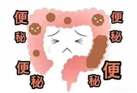 便秘不用愁,四种情况辩证治,帮你解决便秘