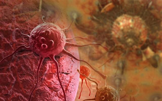 炎症发展成癌，一般需要多长时间？提醒：遇到3种炎症，别再拖延