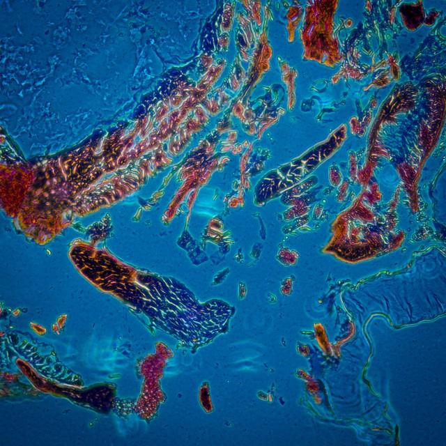 俗话说：“一屁千付药”，常放屁的人和不放屁的人，哪个更健康？