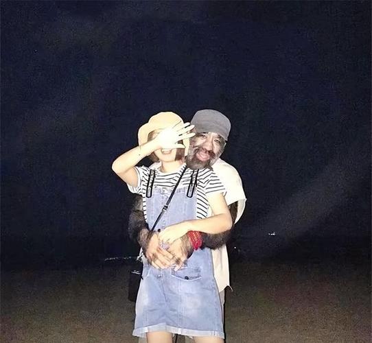 当年轰动一时的“毛孩”：42岁娶90后小娇妻，生一子有无遗传？