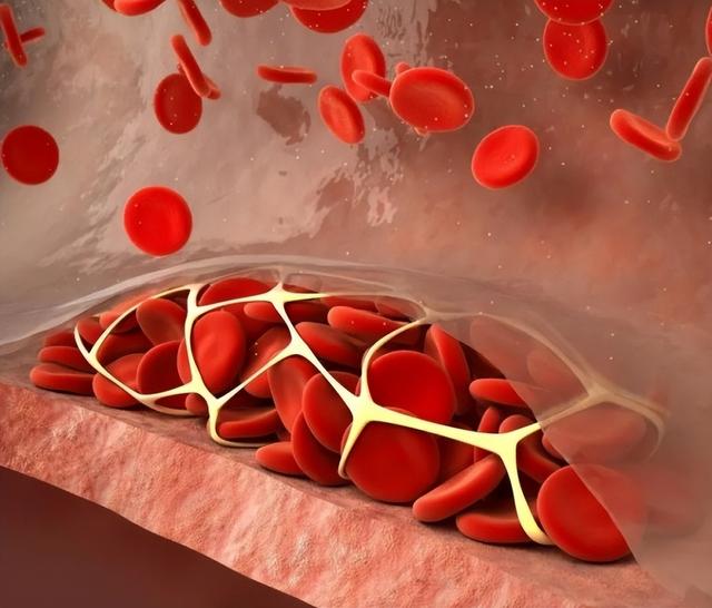 体检发现胆固醇偏高怎么办?改变一个生活习惯,能帮你降下来