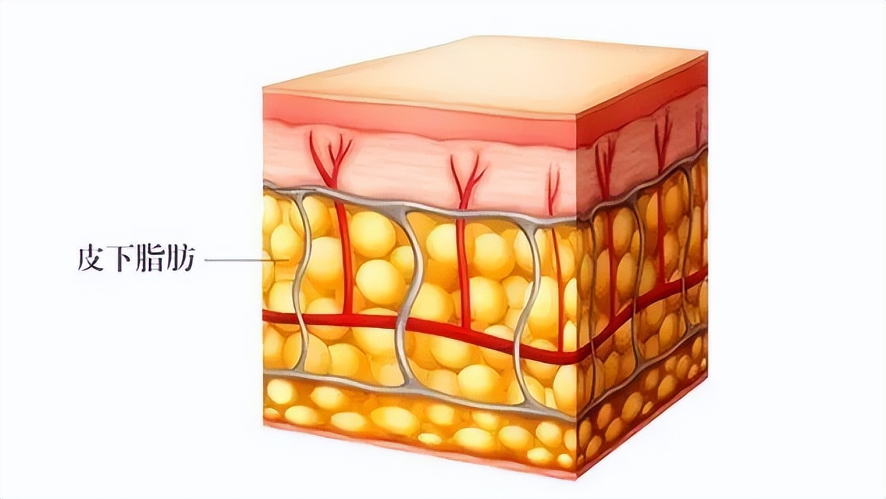 摆脱了肥胖，也摆脱不了脂肪，只有“骗”过脂肪，才能真正变瘦！