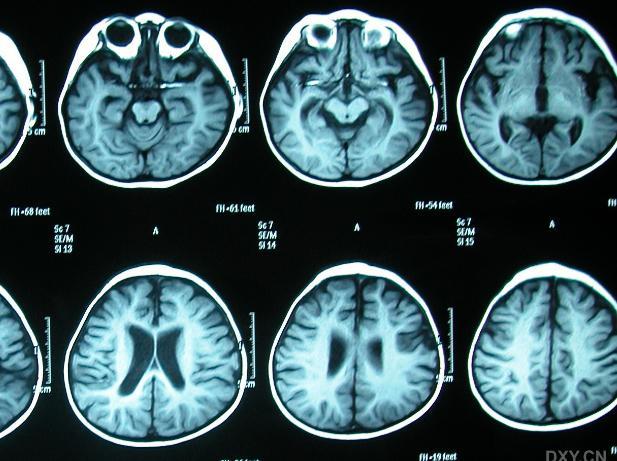 懂行的医生坦言：体检这4项指标正常，身体基本无大碍
