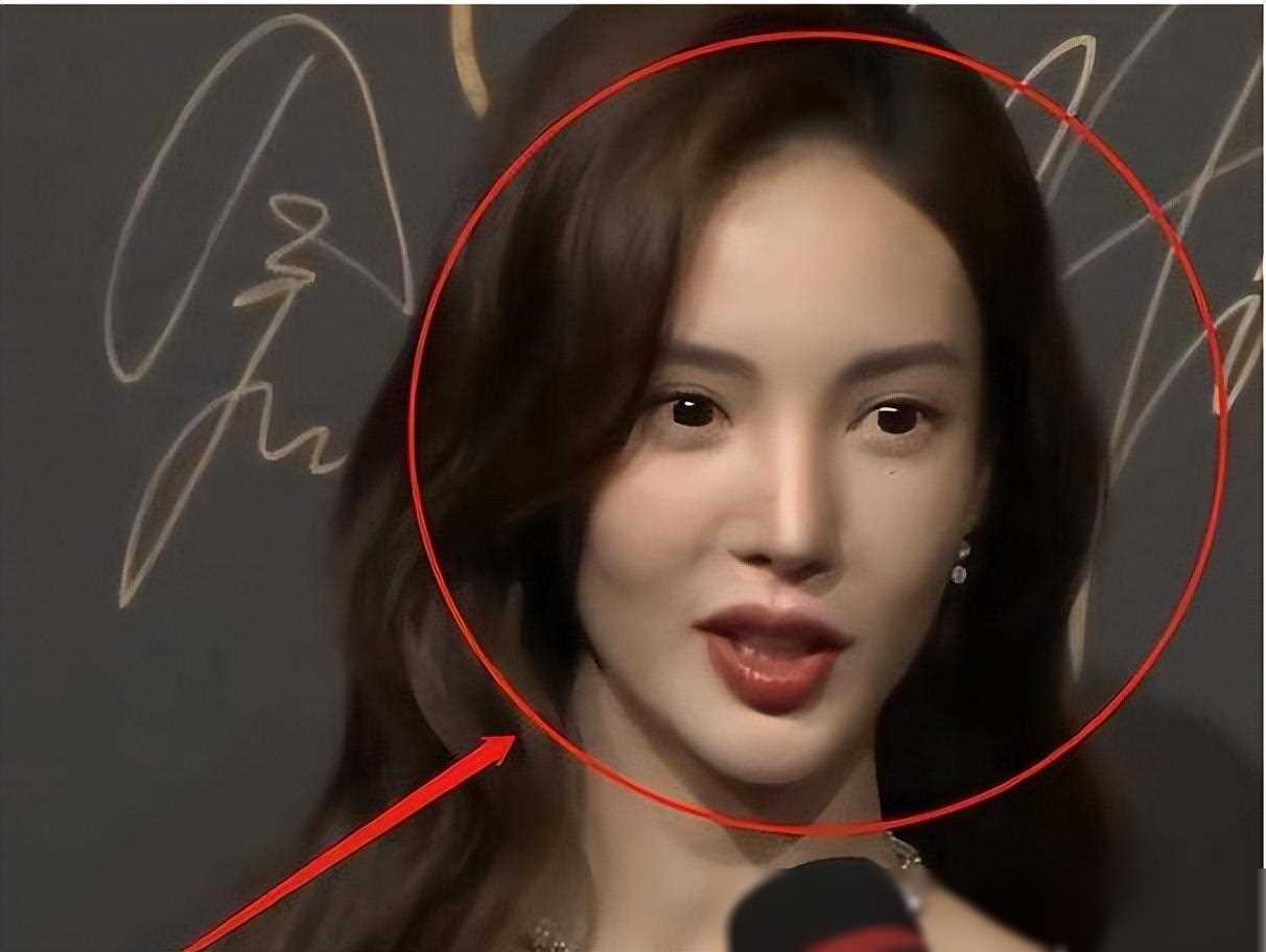 金晨高清怼脸拍!嘴巴转正了,鼻子也不假了!或已取出假体 !