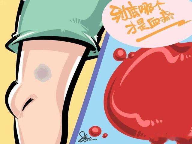 桂枝茯苓丸用对了，让你腿脚不疼了，睡得好了，包块囊肿也赶走了