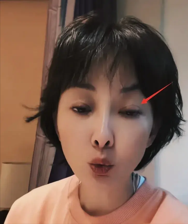 糊涂啊!51岁牛莉整容失败,本人在评论区给网友道歉