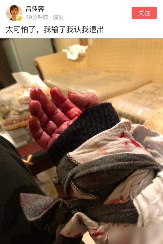 传演员吕佳容出事!曾晒割腕照,称:我出事的话就是和乔任梁一样