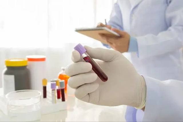 血脂高还吃西红柿？哪怕做成汤也不能吃，医生：再吃会有并发症