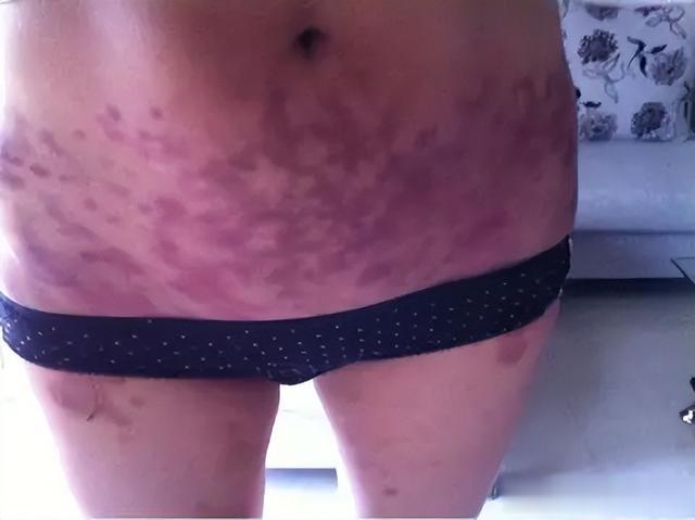 夏天，“拍打腹部”竟然可以缓解这么多慢性病！