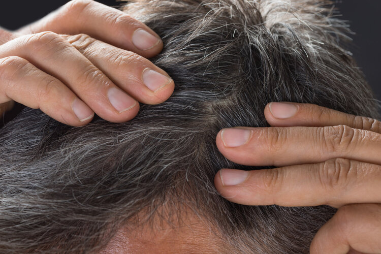 哈佛研究：长白头发的人不易患癌？有科学依据吗？终于等到答案