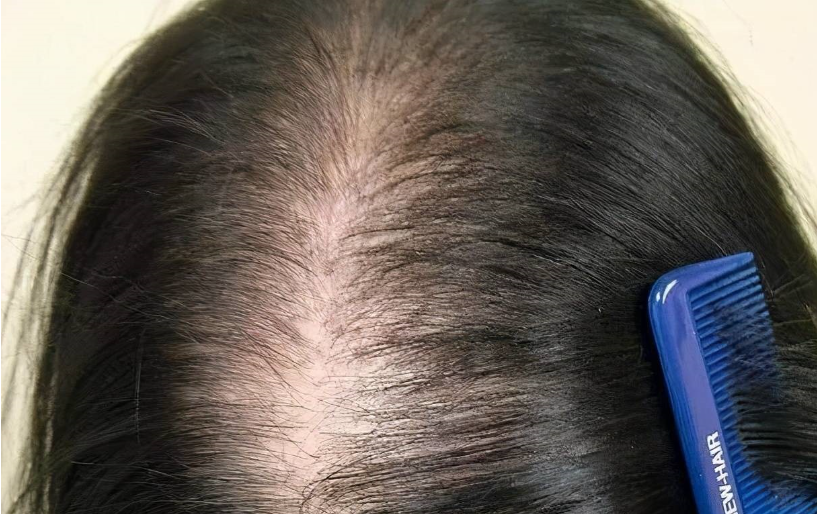 减肥不能碰“瓜子”?提醒:若不想腰上长赘肉,忍住少吃4种主食