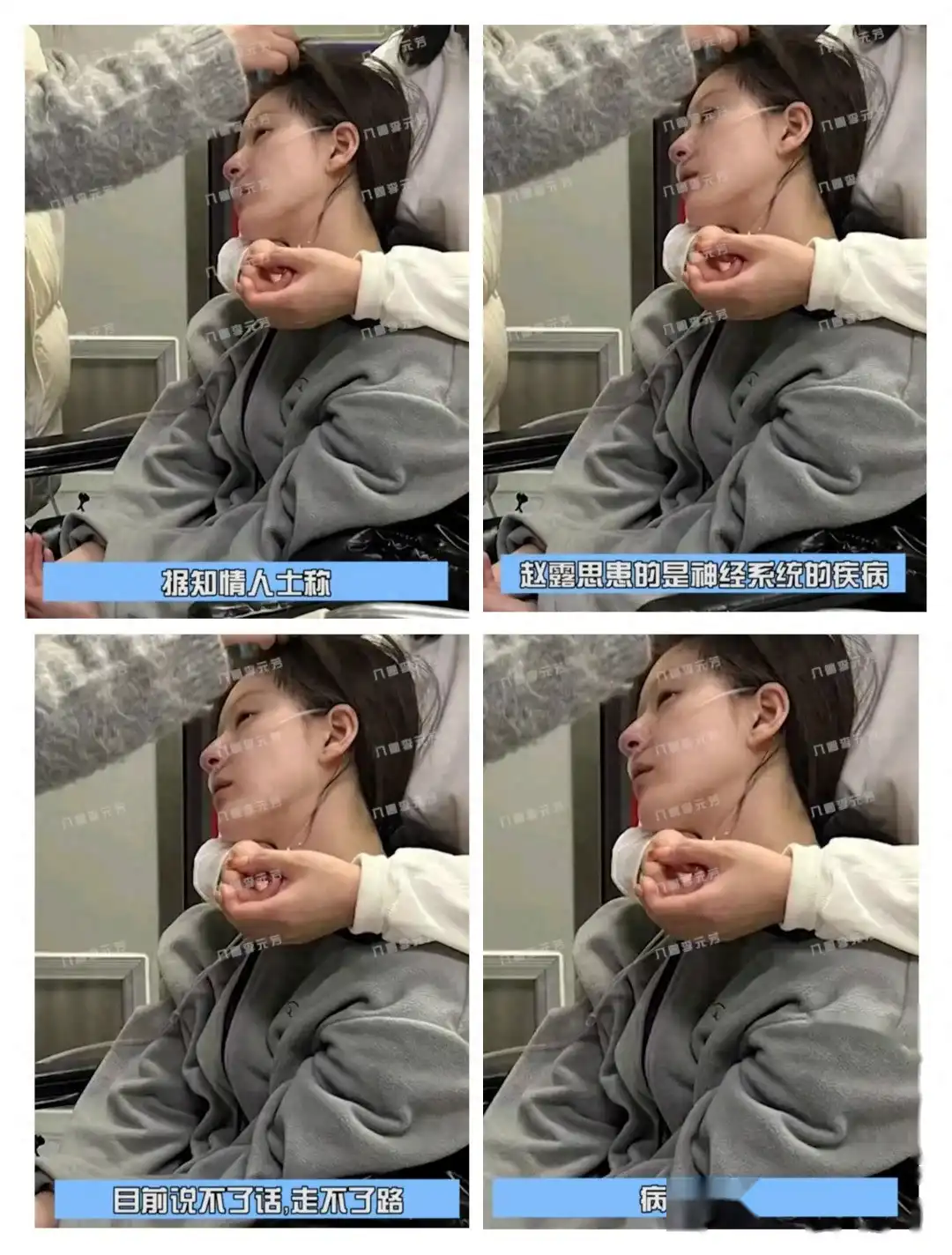 心疼！曝赵露思病情严重，说不了话也走不了路，患神经系统疾病