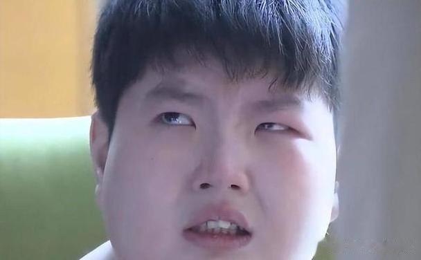 江西14岁男孩体重300斤，一顿饭吃18包泡面，去世前哭着说想减肥