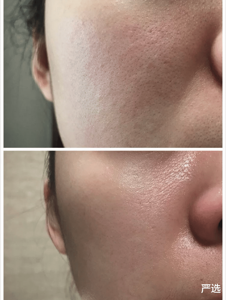 泰国身价3百亿的81岁富婆,整容9年只为“皮肤回春”,如今啥样了