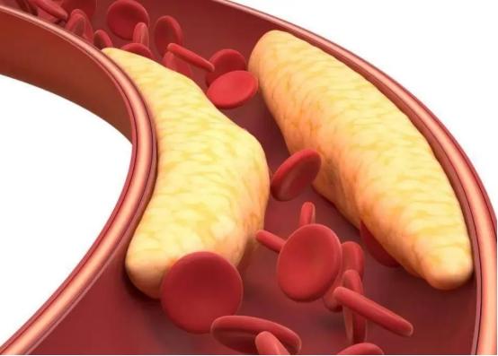 长期喝咖啡，身体最后会怎样？提醒：这3个后果，早知道早好