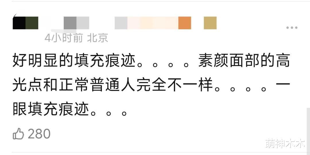 保质期太短？赵露思最新素颜照填充痕迹明显，离开精修油腻又浮肿