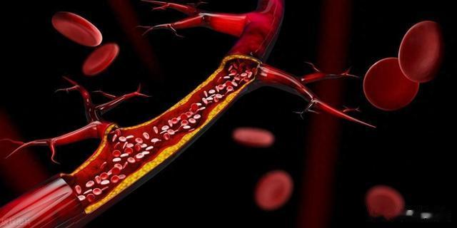 血瘀我不用血府逐瘀，这个方子本事更大，不仅活血，还能祛痰湿