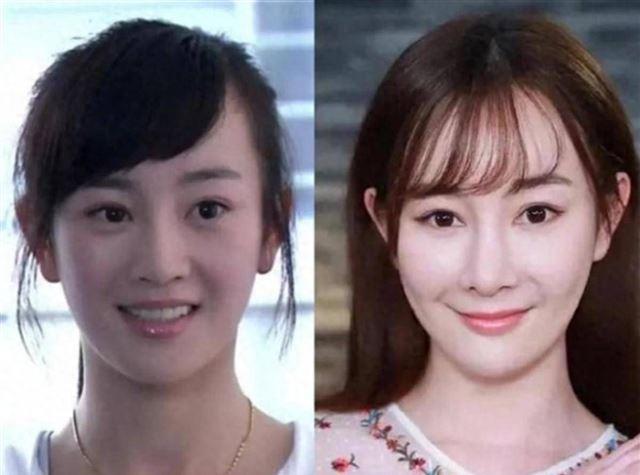 以为退圈了，没想到是“换脸”认不出来，这5位动脸的女星太可惜