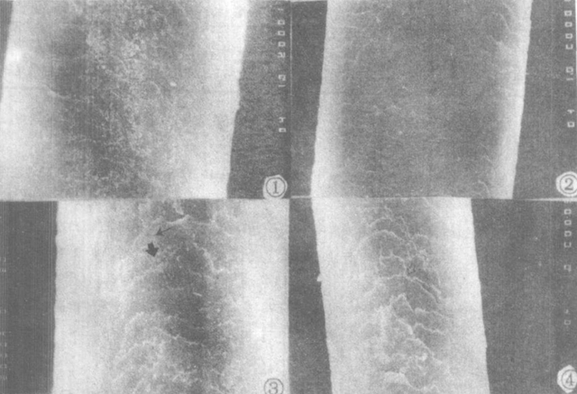 为什么头发会分叉？