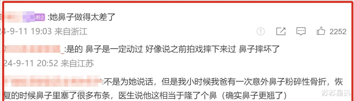 34岁金晨在节目中睡觉时,鼻孔和嘴巴都带着保持器,再陷整容质疑