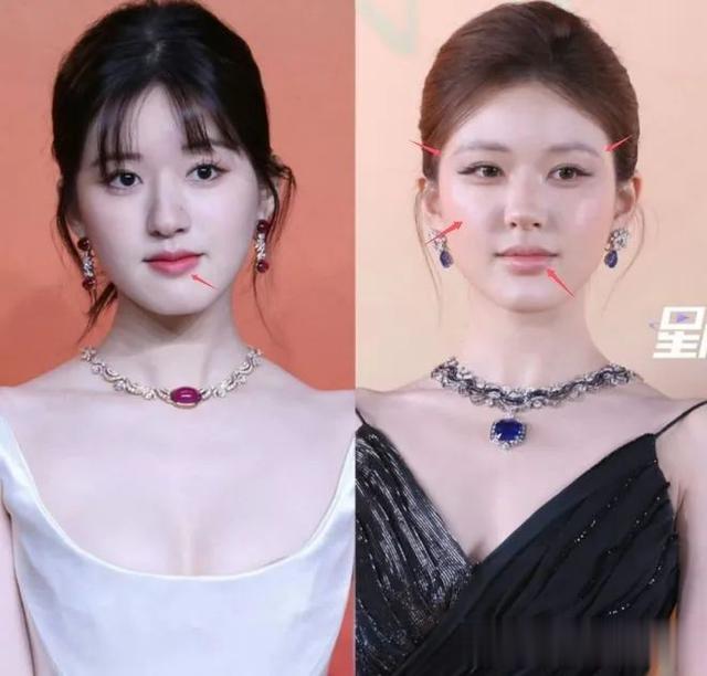 赵露思宝格丽生图嘘声一片，人瘦脸肿如大变活人，腋下太脏好尴尬