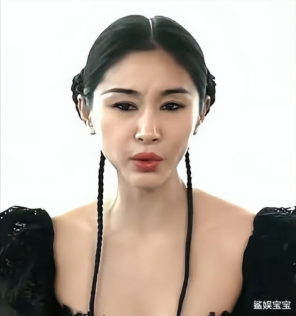 王子文脸部肿胀崎岖,下巴突出来一块,有点像“医美后遗症”