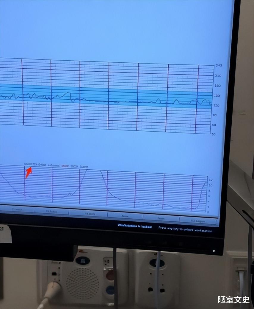 叶海洋三胎风波升级,多个疑点被扒出,或许从怀孕开始就是假的?