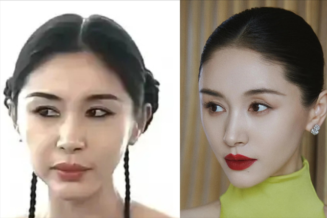 37岁王子文大变样!脸部肿胀扭曲不敢认,网友辣评:医美后遗症