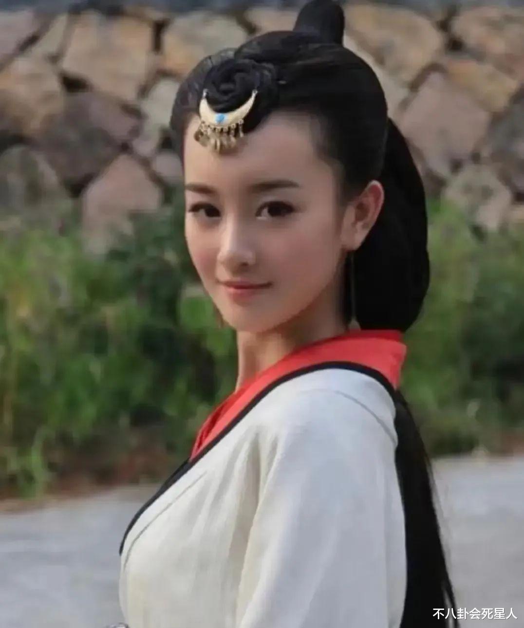 鞠婧祎近照变样,金莎脸僵浮肿,这6位明星动脸后遗症都出来了