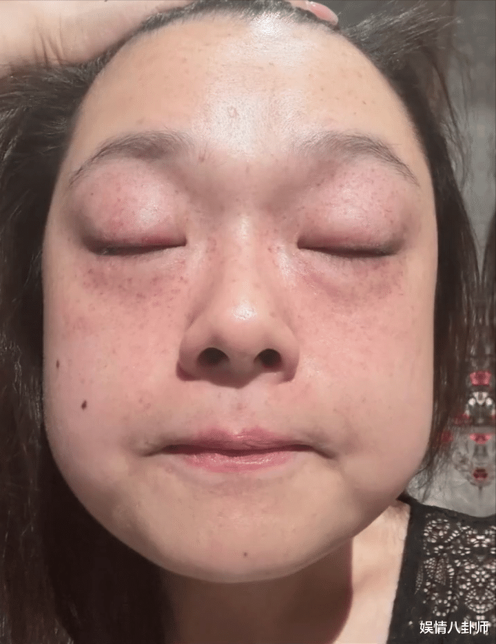 港版“贾玲”陈嘉佳暴瘦142斤，比贾玲还强悍，素颜照曝出却令人忧心