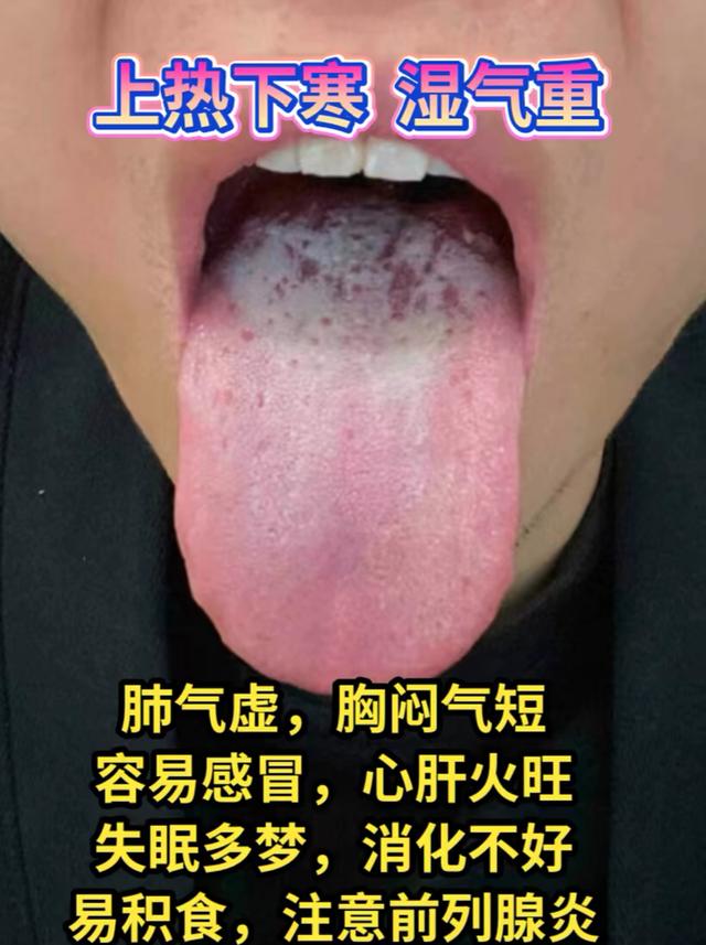 潘医生舌诊—实战分析：肾阳不足，肾阴不足，肾精亏虚