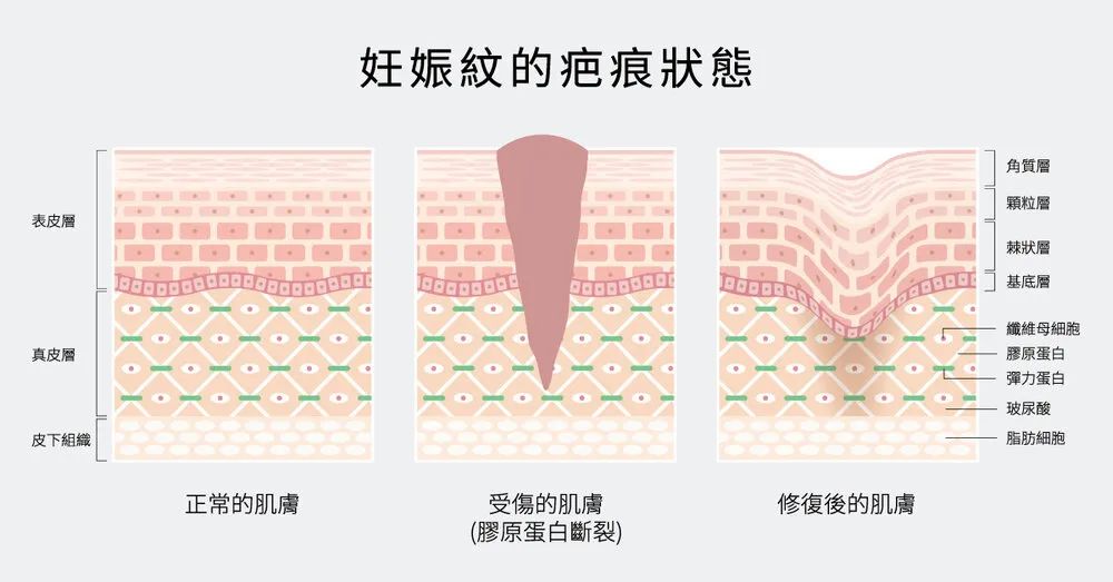 她别真是未婚先孕吧,顶着自毁前程的风险也要和渣男闪电完婚