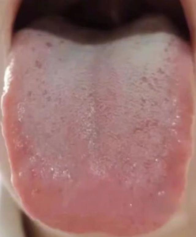 你以为的懒，其实是气血亏虚的信号。学会用这个药，补足全身气血