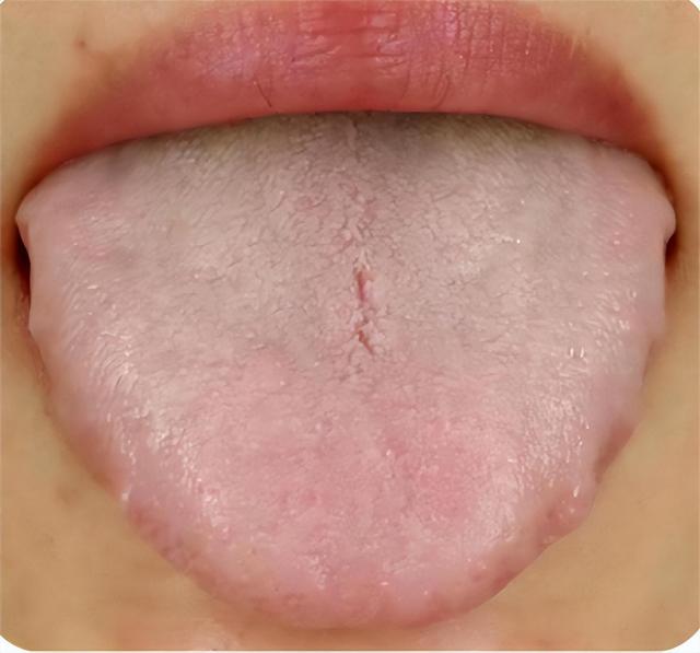 补血猛将：归脾丸 大补阴丸 人参养荣丸，谁才是真正的补血将军？