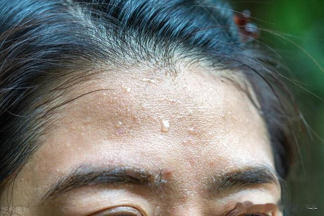 动不动“满头大汗”,身体哪里出问题了?中医分析4种原因