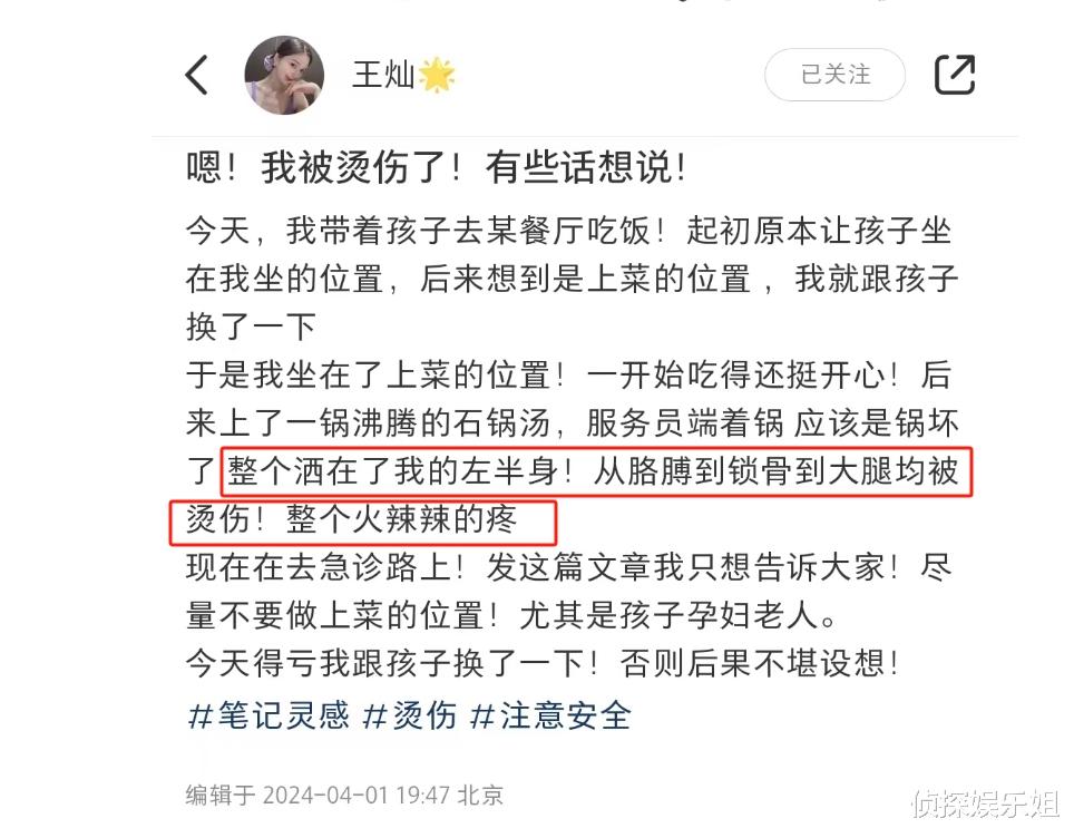 杜淳老婆带女儿吃饭，左半身被沸汤烫伤，幸运及时跟孩子换了位置