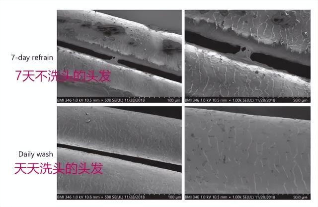 头发多久洗一次才最好?5个洗头习惯让你头发越洗越少!