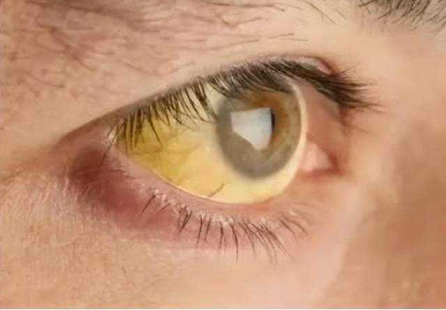 寿命长短,看脸就知道?寿命短的人,一般会有4个特征