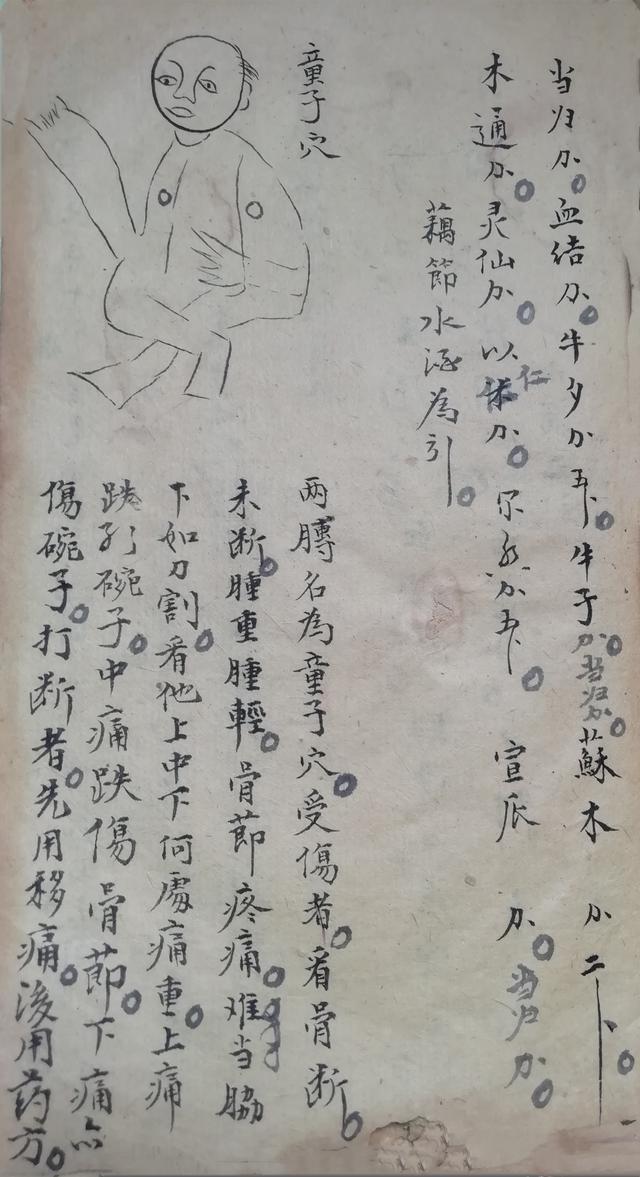 跌打损伤伤穴位秘方古书籍