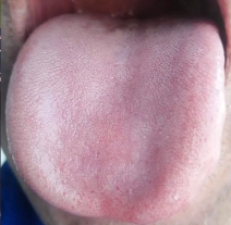 阳气越少，汗越多，教你一个方子，把阳气补足了，汗也就少了。