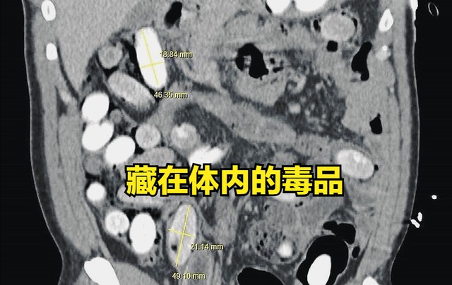 王星事件还没结束,陈奕迅泰国演唱会就出事,主办方:不允许退票