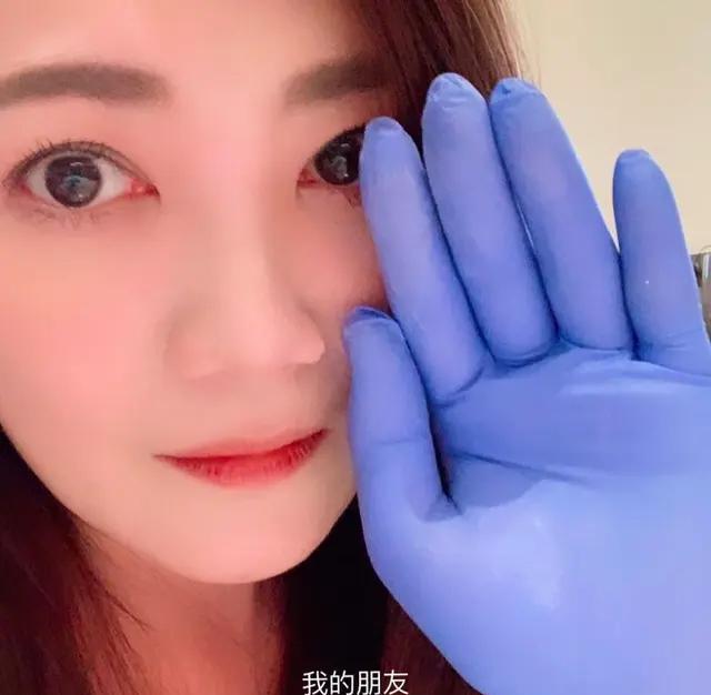 “小丑手”太减分了,这6位女星看脸貌美如花,却被手“拖后腿”