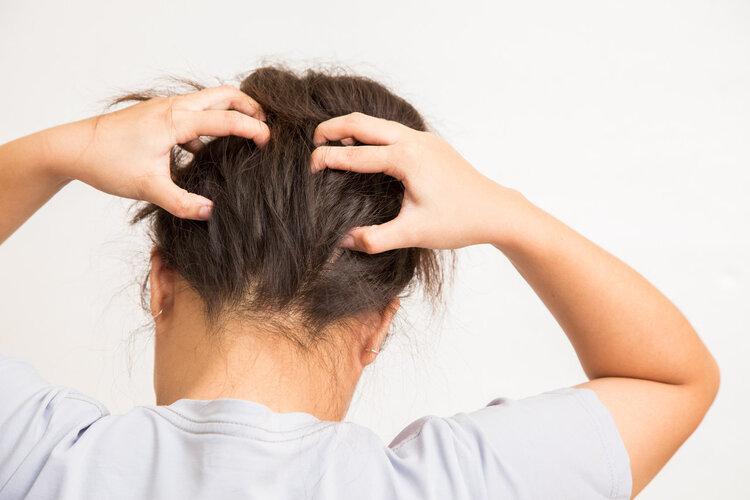 头皮老是长疙瘩和脓包,是怎么了?是癌症前兆吗?别不当回事