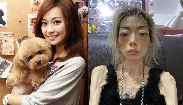 被过度减肥“毁掉”的5位女明星，越瘦越干瘪，越练越苍老