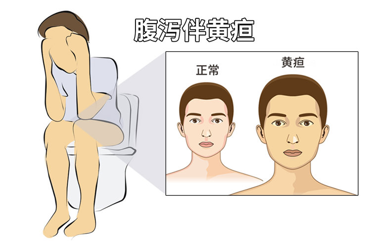 胰腺癌“祸根”被揪出,比吸烟危害还大?很多老人都爱吃,早了解