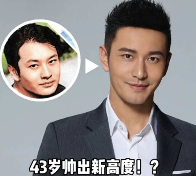 靠整容翻身的5位男星，个个换脸后事业一飞冲天，来看看都是谁