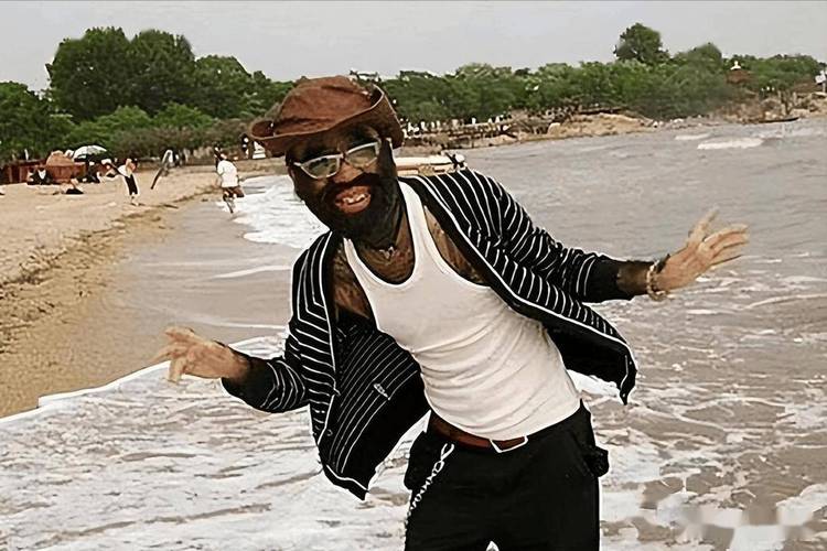 当年轰动一时的“毛孩”：42岁娶90后小娇妻，生一子有无遗传？