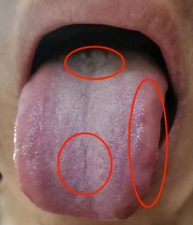 祛不完的湿健不完的脾，祛湿不能忽视肝肾，做对三步横扫一身湿气